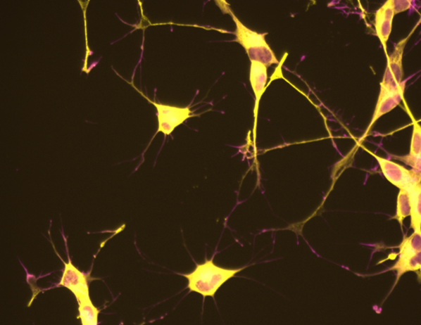 Fluorescence microscopy — differentiated neurons